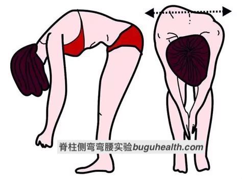 弯腰实验/前屈实验/布骨脊柱侧弯矫形中心