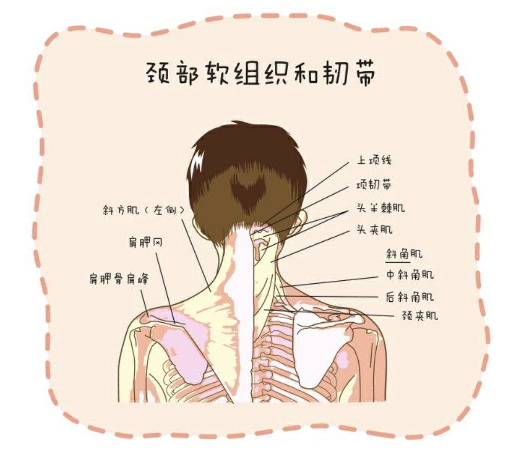 颈椎疾病发病机制以及造成颈椎疼痛的因素